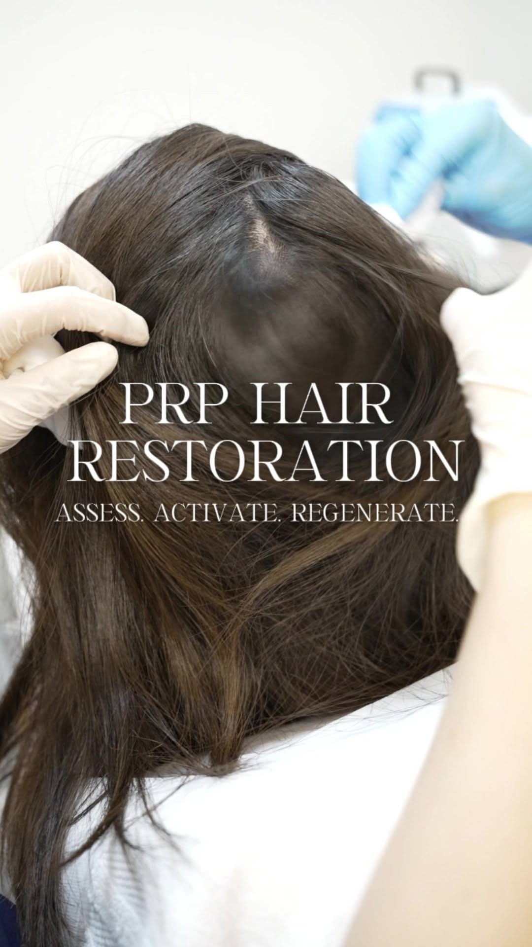Post 9 by ID Cosmetic Clinic on Instagram (video)