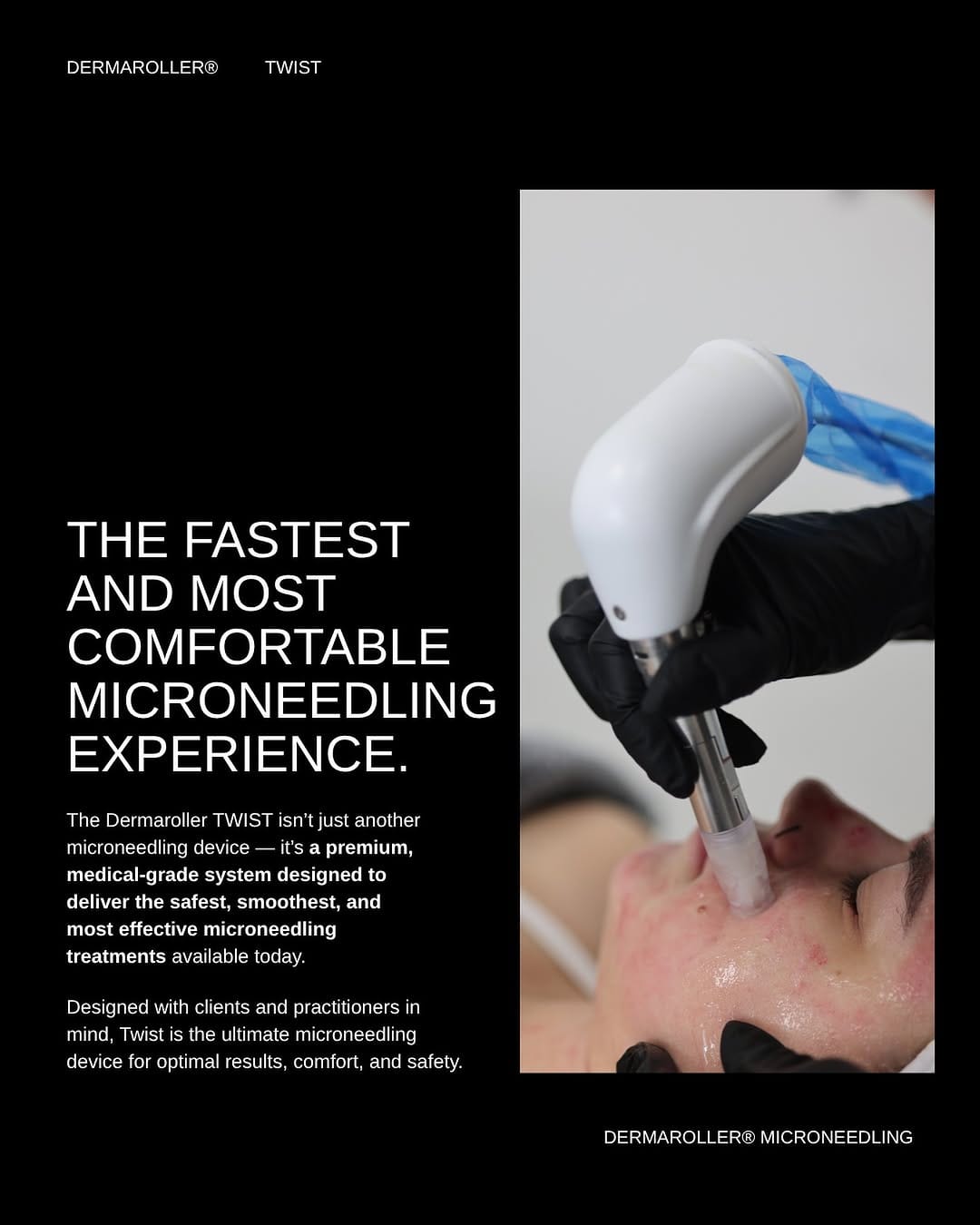Post 9 by Dermaroller® | Canada's Ultimate Microneedling Device on Instagram (image)