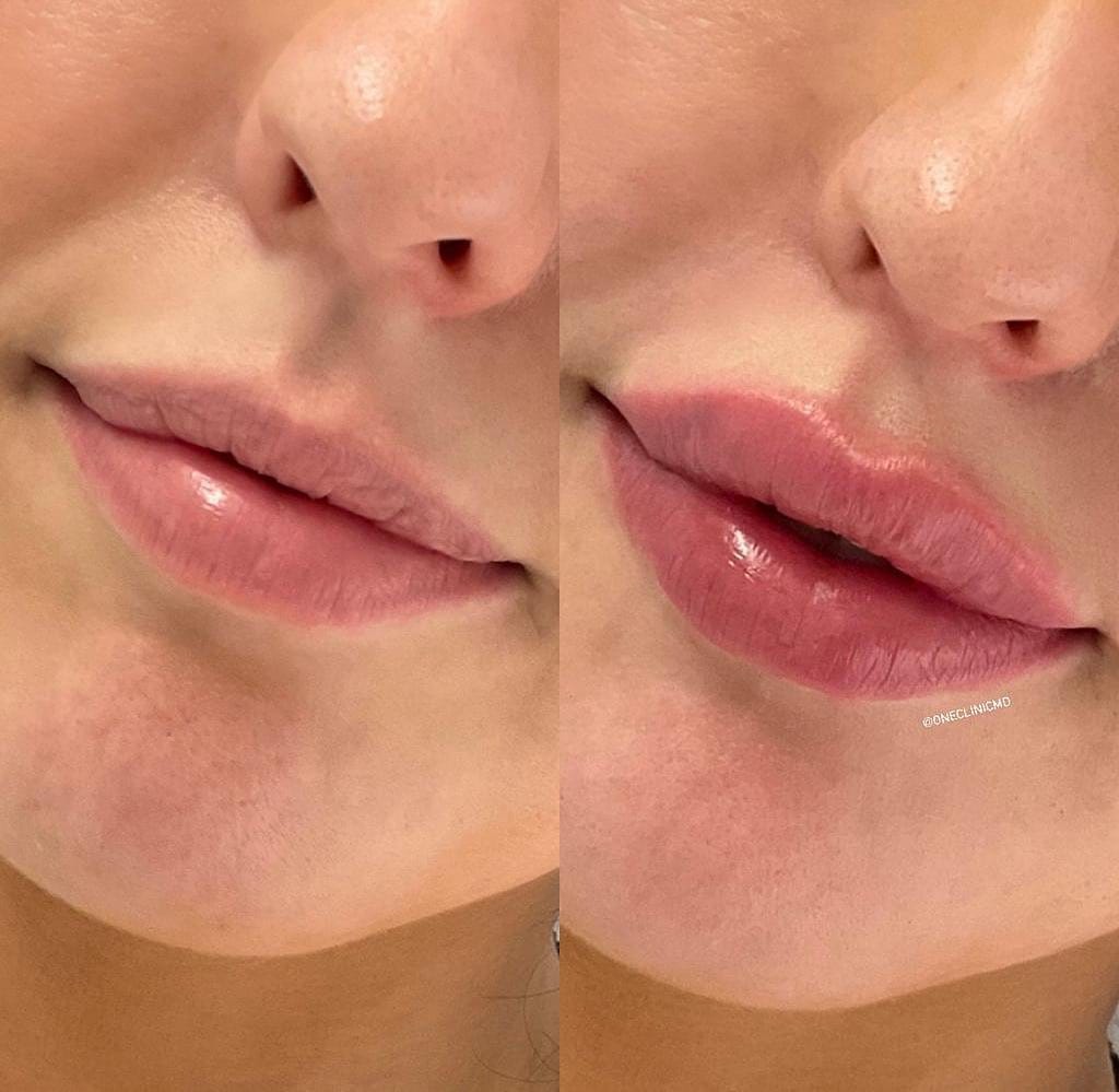 Post 10 by One Clinic MD on Instagram (image)