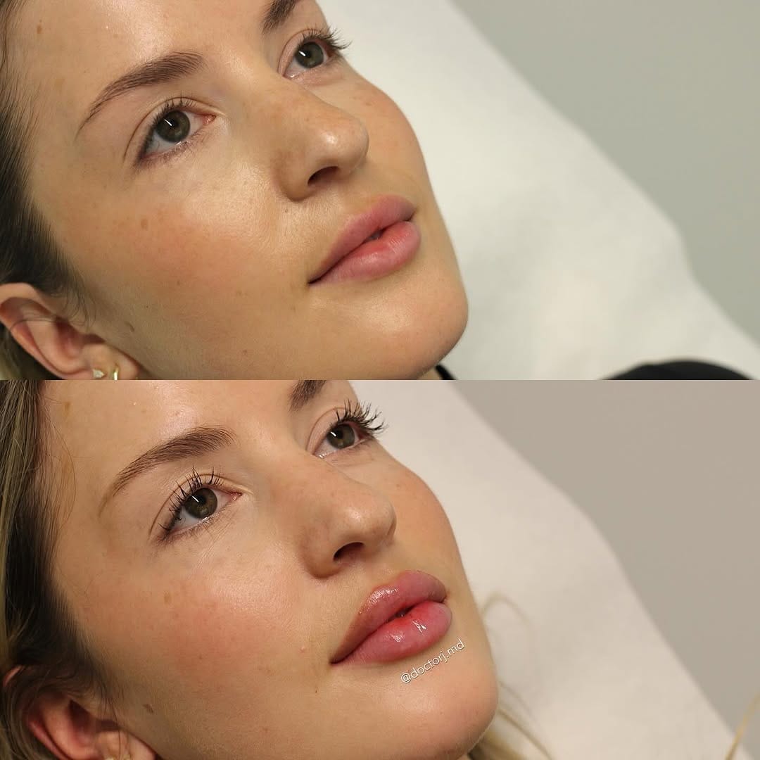 Post 8 by One Clinic MD on Instagram (carousel)