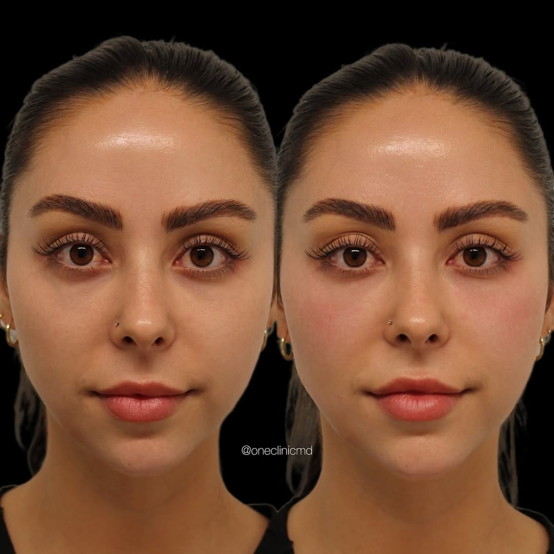 Post 9 by One Clinic MD on Instagram (carousel)