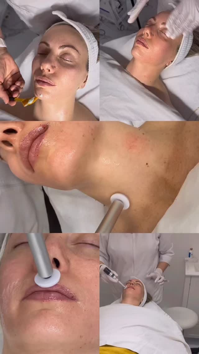 Post 7 by Le Miracle Skin Clinic on Instagram (video)