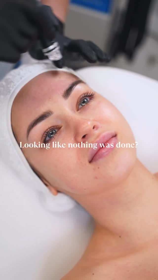 Post 1 by NEA Precision Skin on Instagram (video)