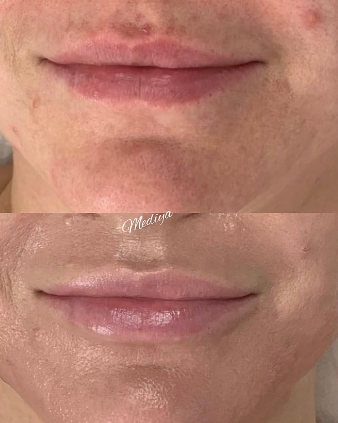 Post 4 by Raspina Beauty Academy on Instagram (image)