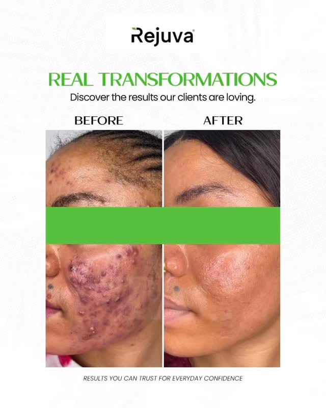 Post 2 by The Aesthetic Clinic on Instagram (video)