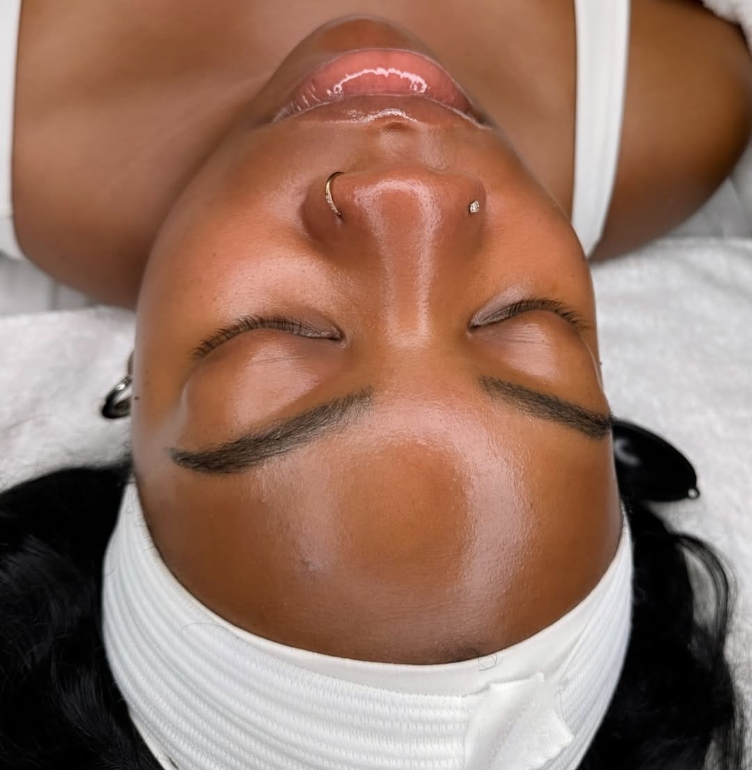 Post 9 by Adebimpe Akindele | hhbeautyspa | Acne & Skin Specialist on Instagram (carousel)