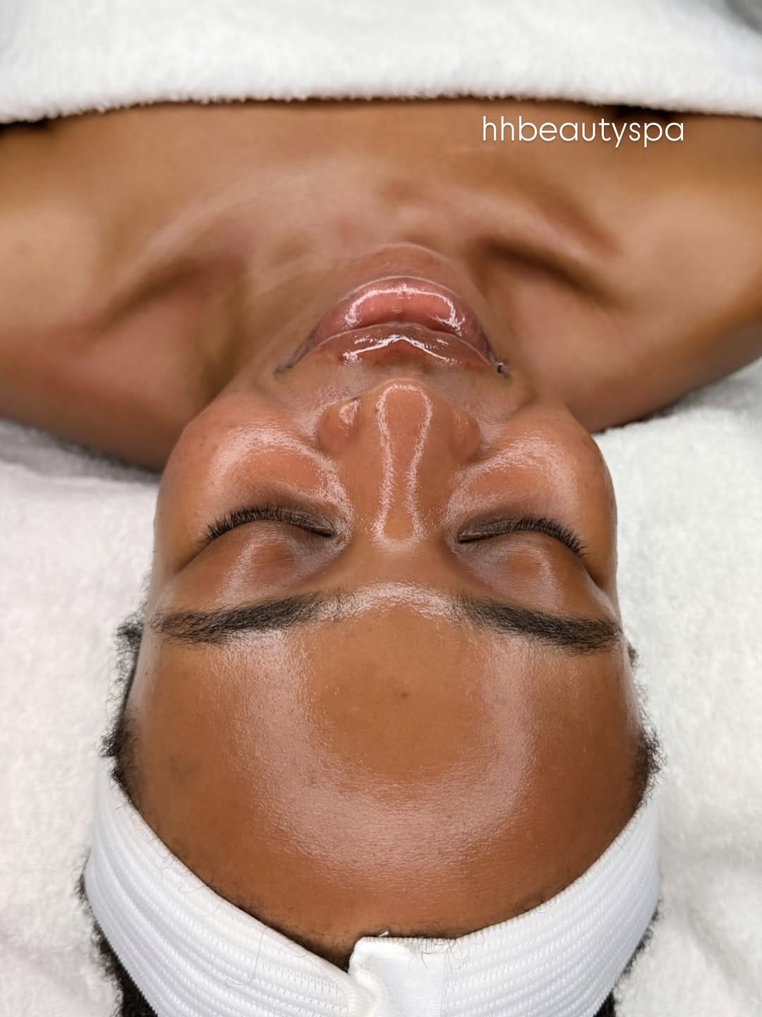 Post 1 by Adebimpe Akindele | hhbeautyspa | Acne & Skin Specialist on Instagram (carousel)