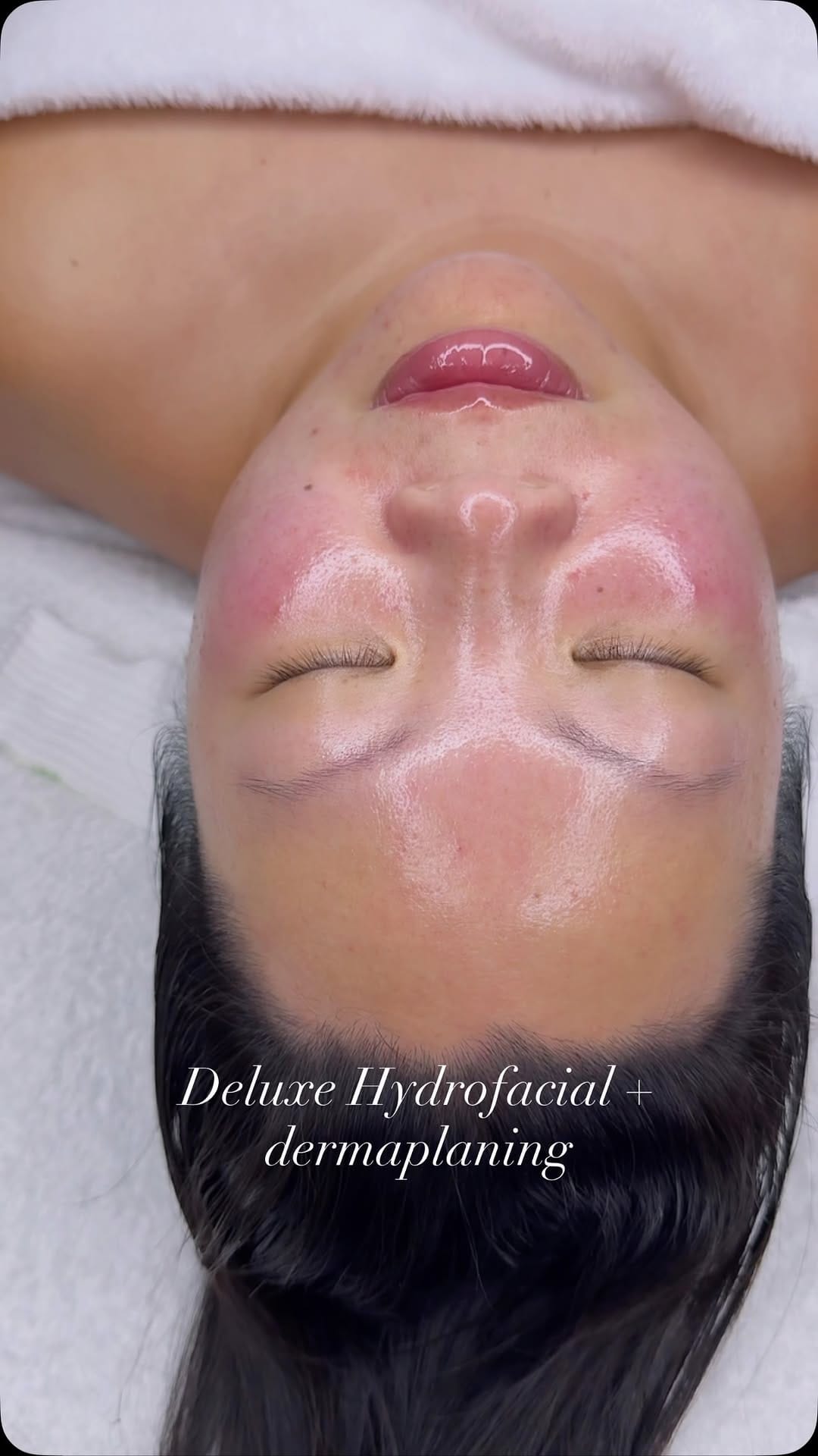 Post 2 by Adebimpe Akindele | hhbeautyspa | Acne & Skin Specialist on Instagram (video)