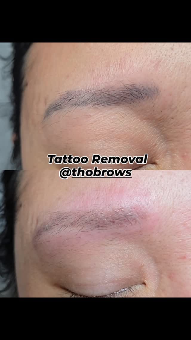 Post 7 by Toronto Microblading Brows & Lip Blush Studio on Instagram (video)
