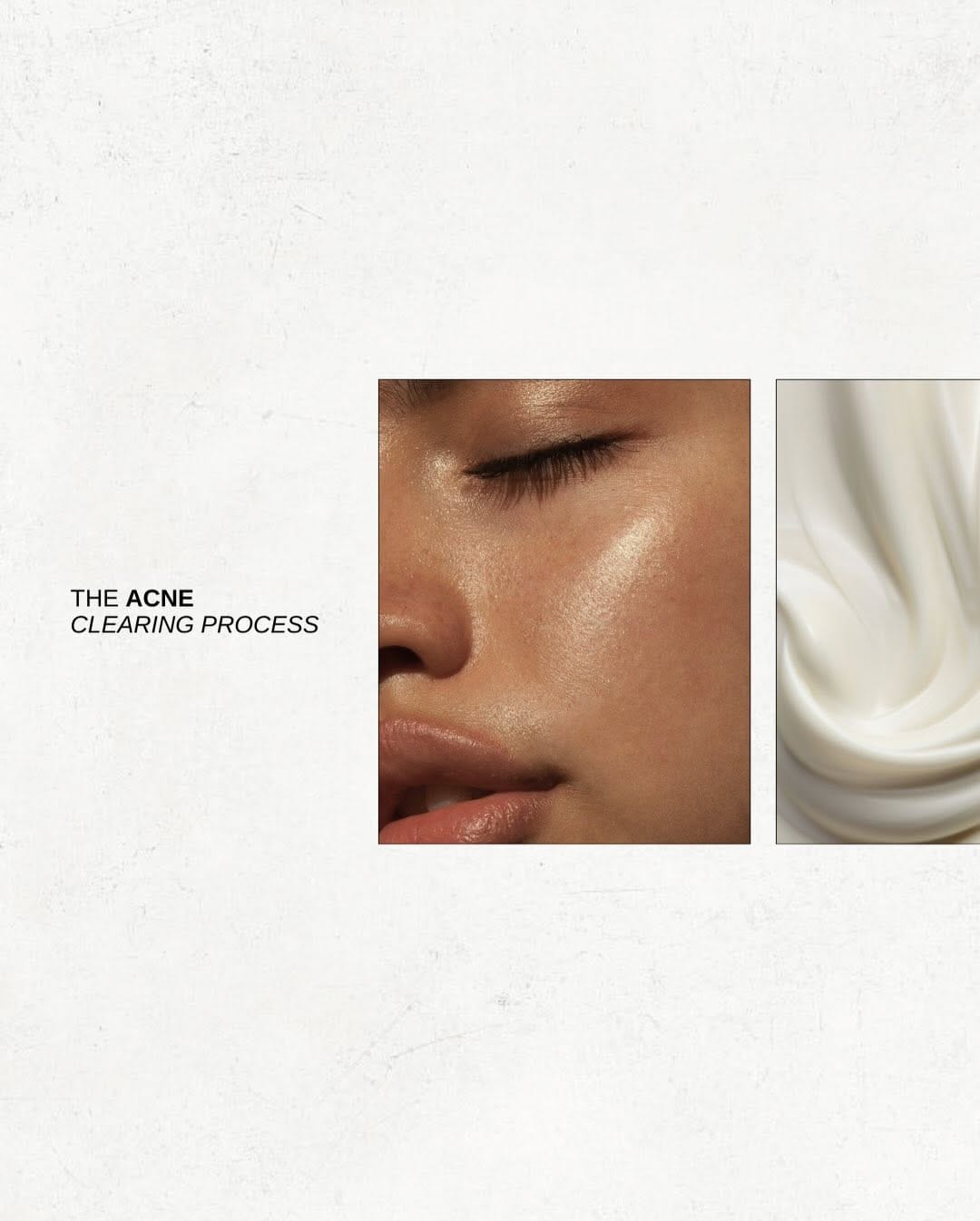 Post 1 by JILL B / Canada’s Acne Specialist ™️ on Instagram (carousel)
