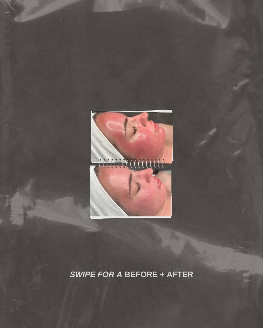 Post 10 by JILL B / Canada’s Acne Specialist ™️ on Instagram (carousel)