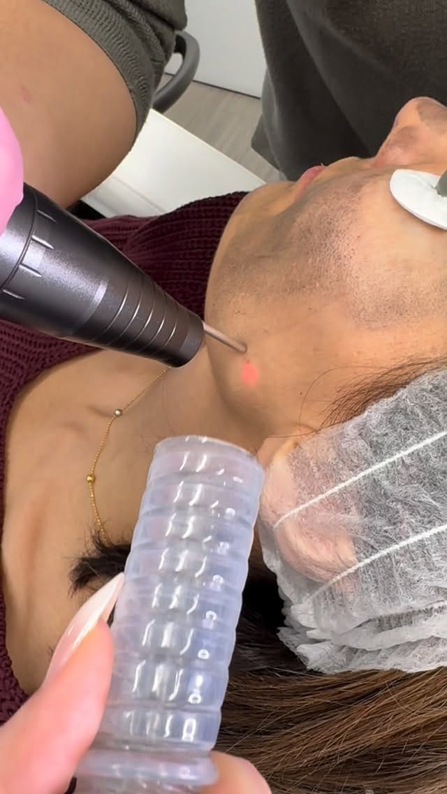 Post 3 by 4D Skin Care Clinic on Instagram (video)