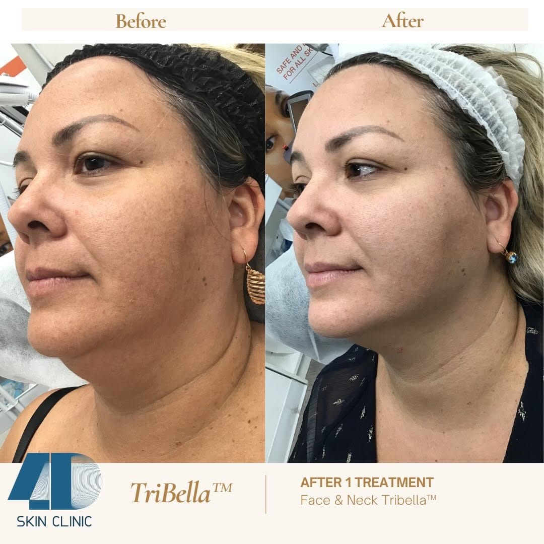 Post 2 by 4D Skin Care Clinic on Instagram (carousel)