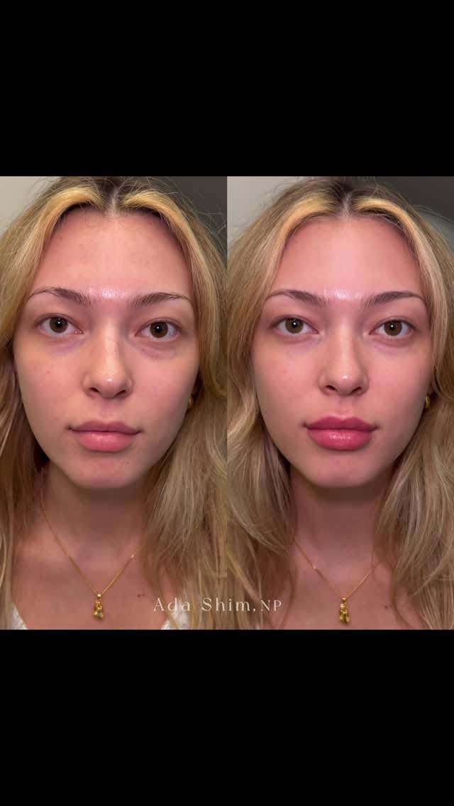 Post 9 by Ada Shim MN NP-PHC on Instagram (video)