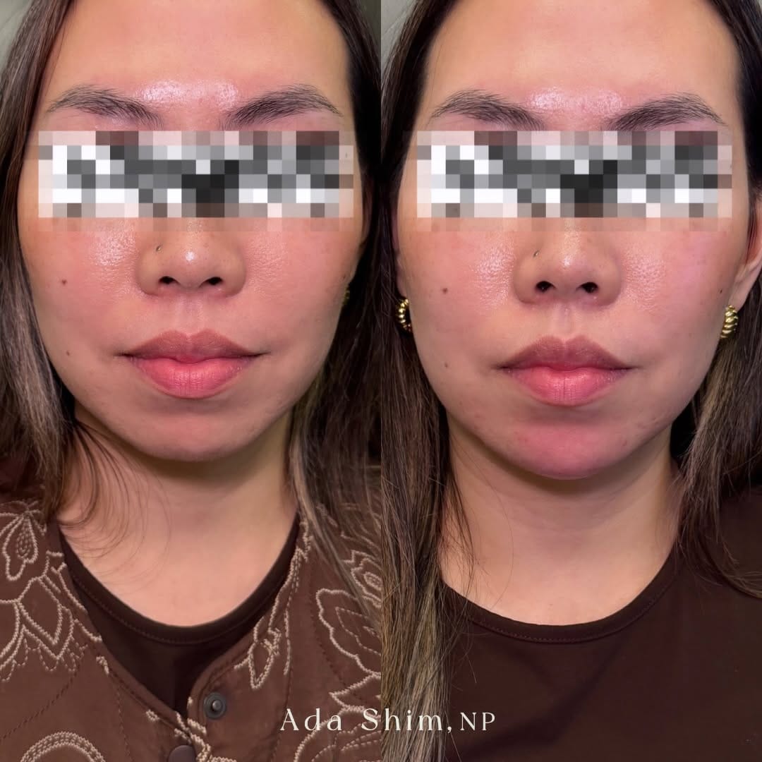 Post 1 by Ada Shim MN NP-PHC on Instagram (carousel)