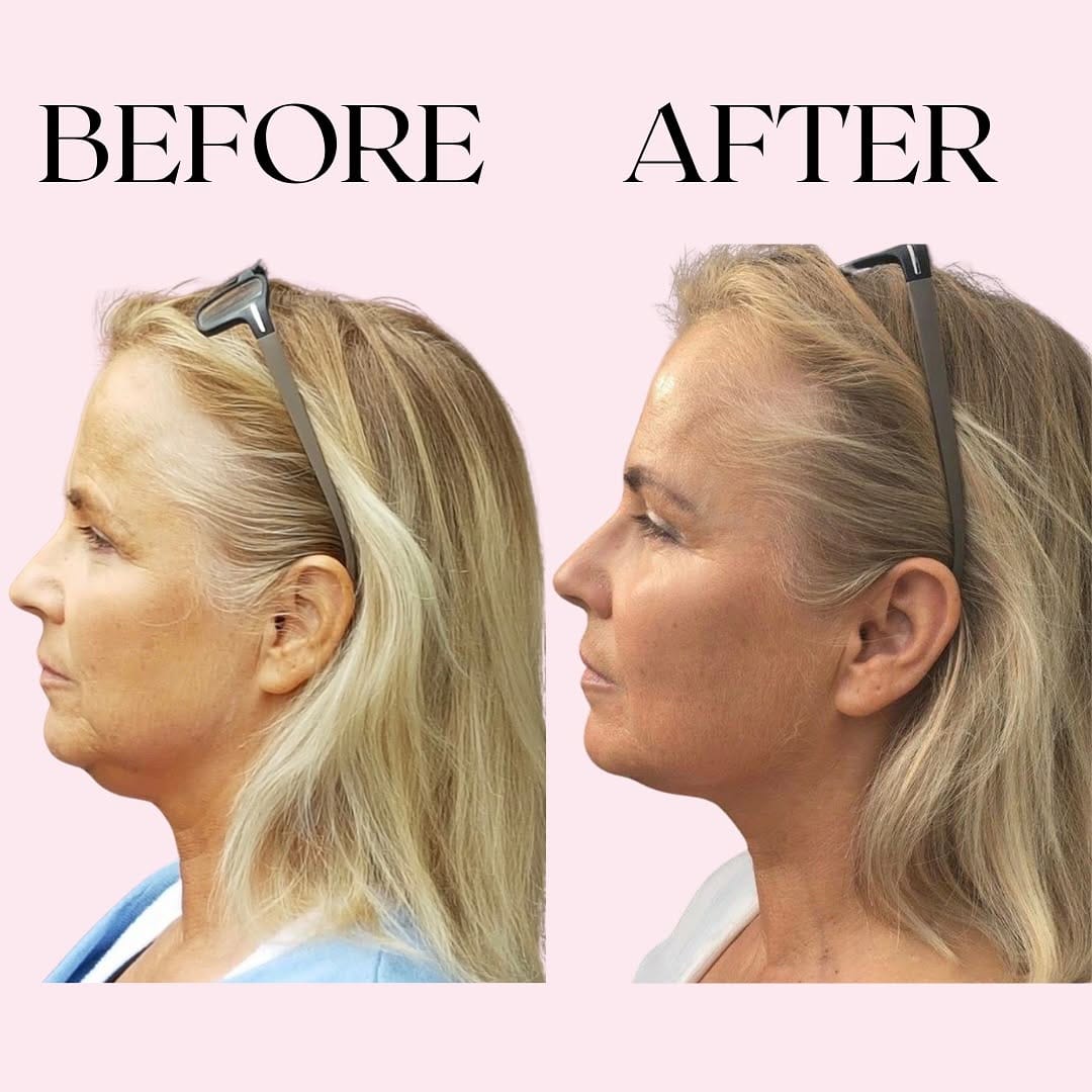 Post 8 by Sophia Ha | Canada's leading Certified Face Yoga Educator on Instagram (carousel)