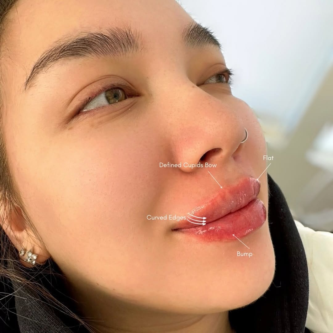 Post 8 by Ottawa Cosmetic Nurse || MB on Instagram (image)