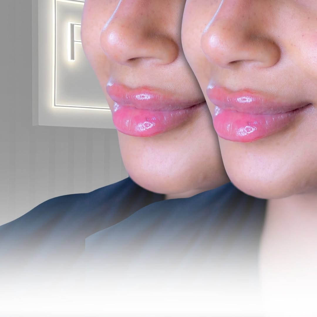 Post 9 by Ottawa Cosmetic Nurse || MB on Instagram (image)