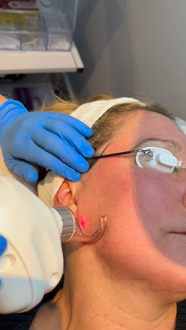 Post 7 by Freedom Medi-Spa Vaughan on Instagram (video)
