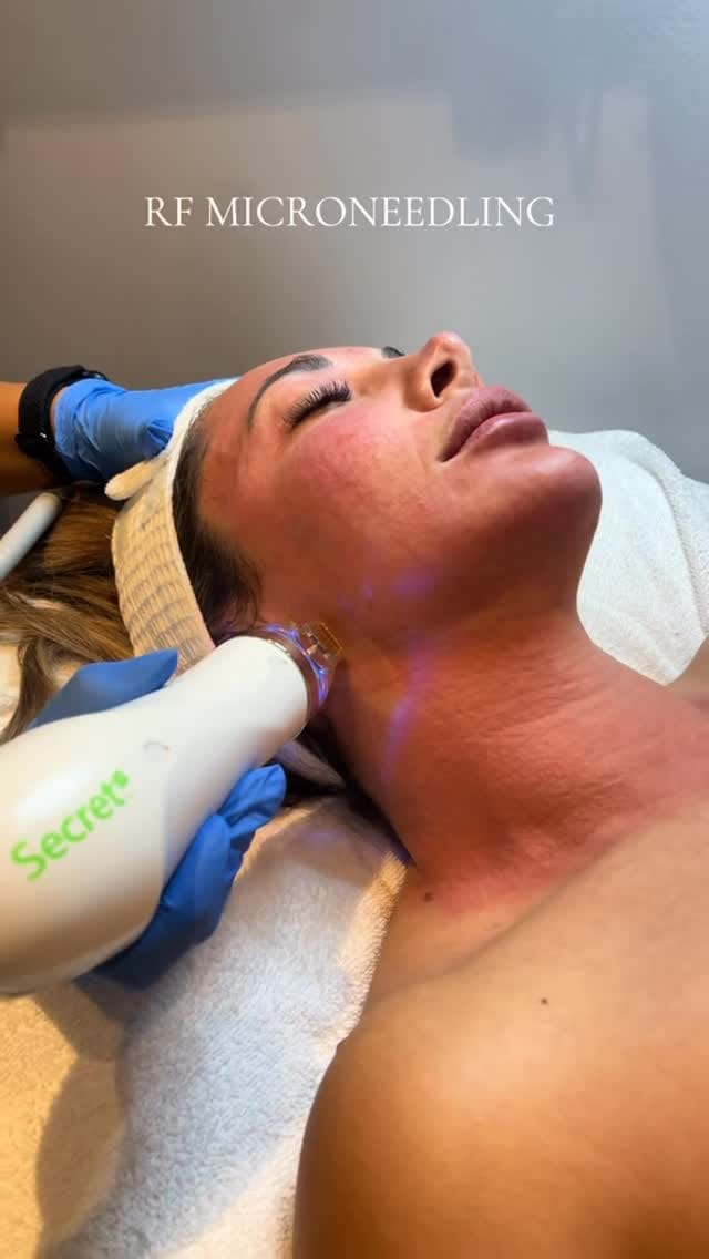 Post 8 by Freedom Medi-Spa Vaughan on Instagram (video)