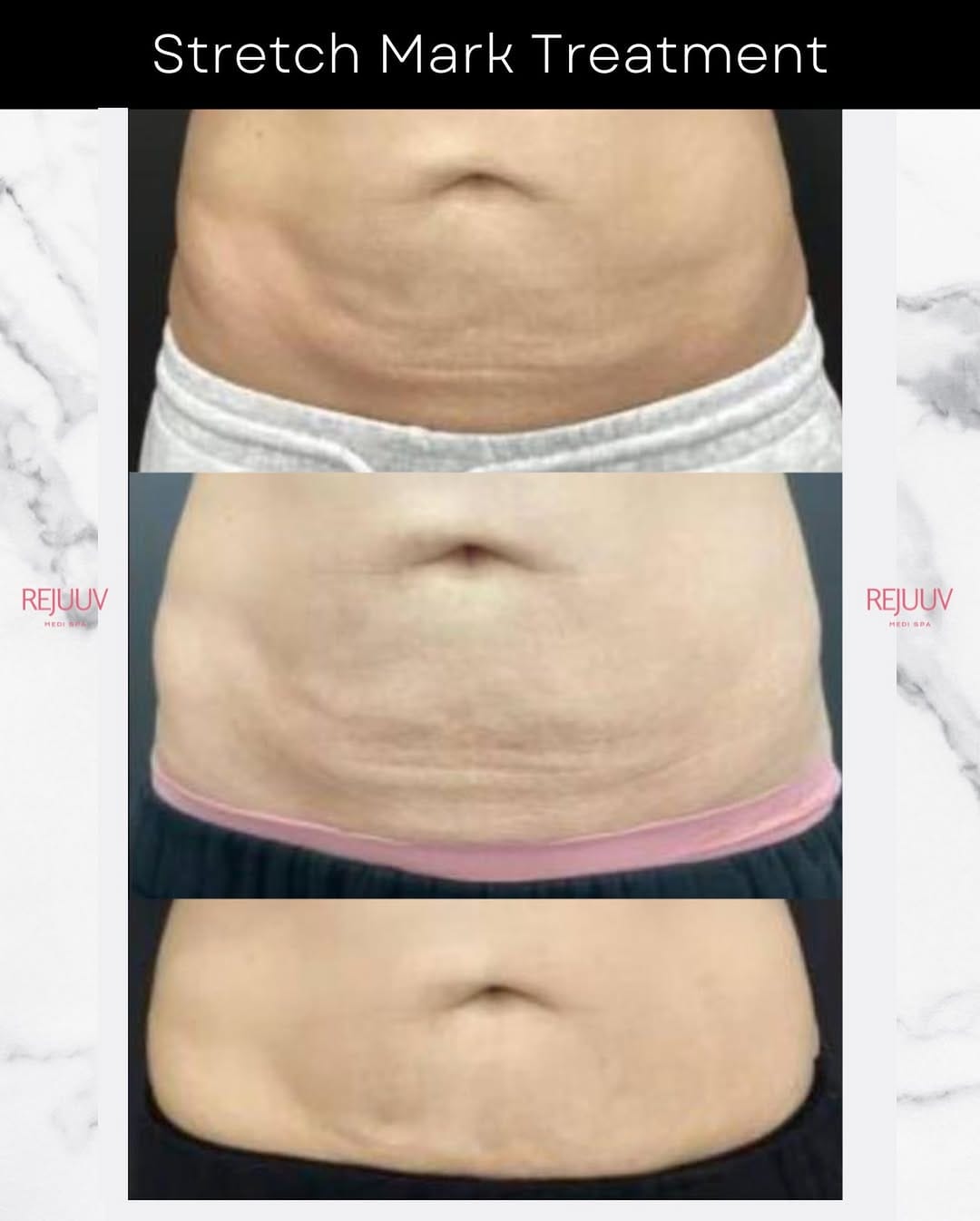 Post 6 by Rejuuv Medi Spa on Instagram (image)