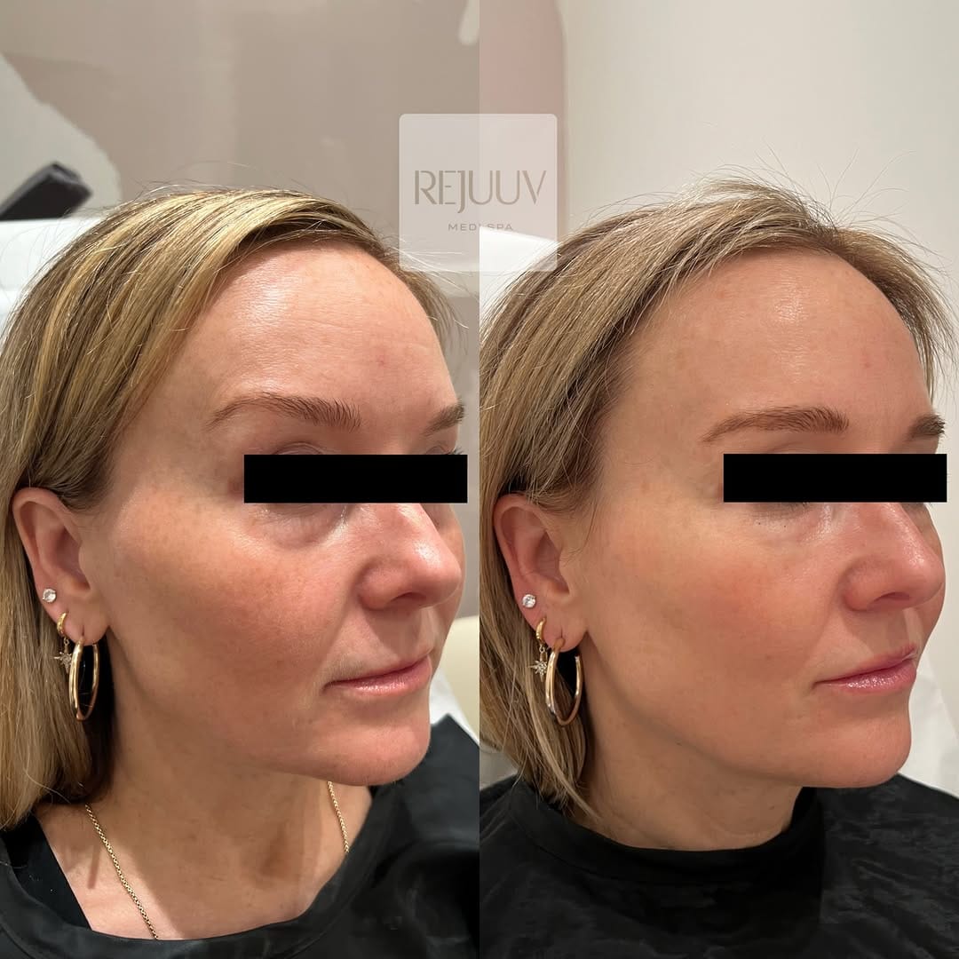 Post 1 by Rejuuv Medi Spa on Instagram (image)