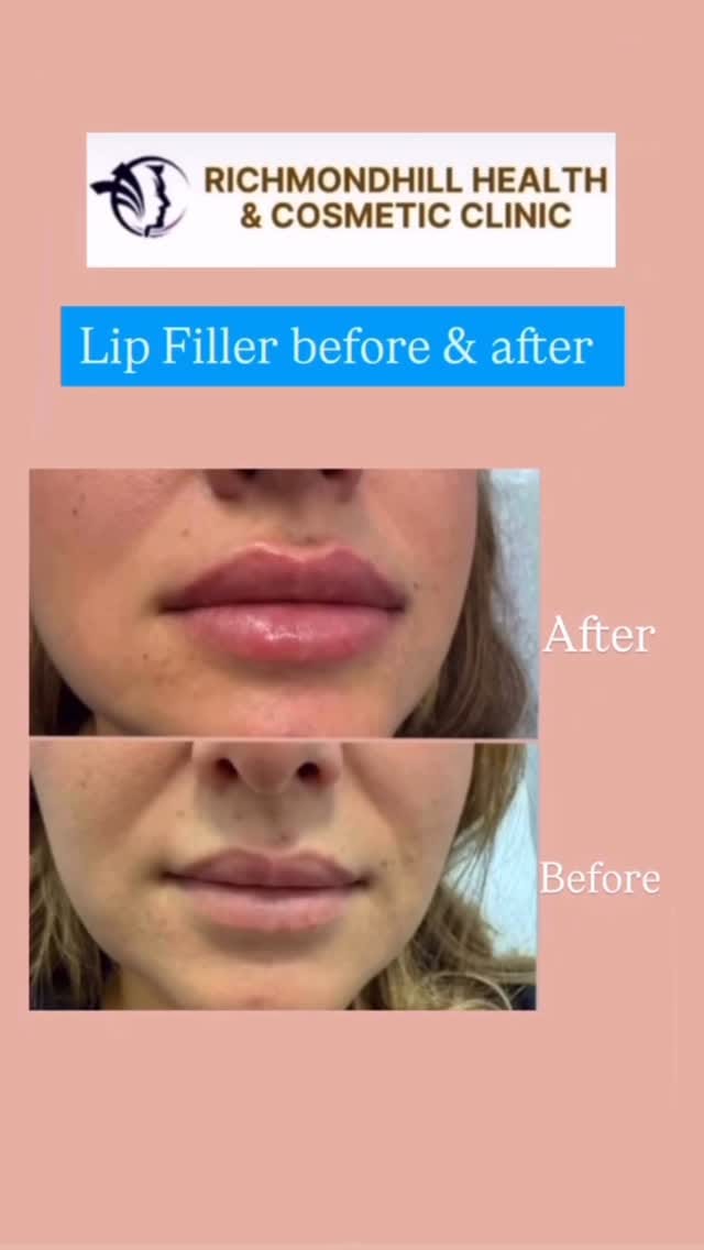 Post 2 by RHCCLINIC on Instagram (video)