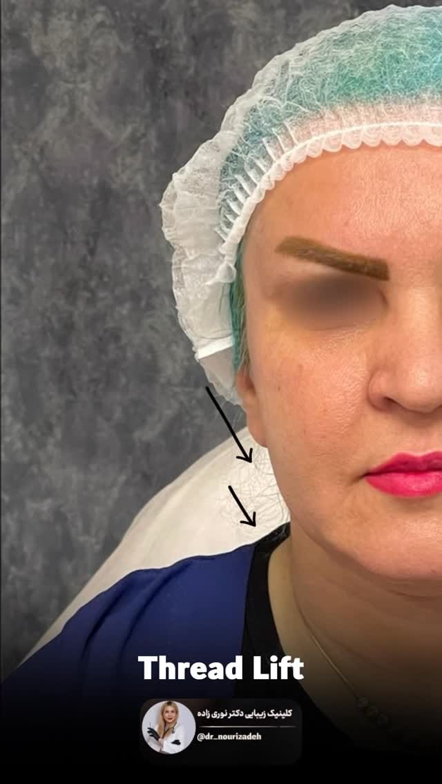 Post 1 by Helen Nourizadeh, MD on Instagram (video)
