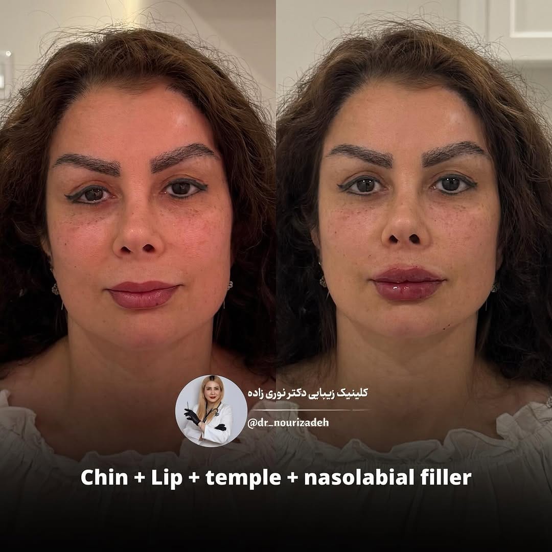 Post 4 by Helen Nourizadeh, MD on Instagram (image)