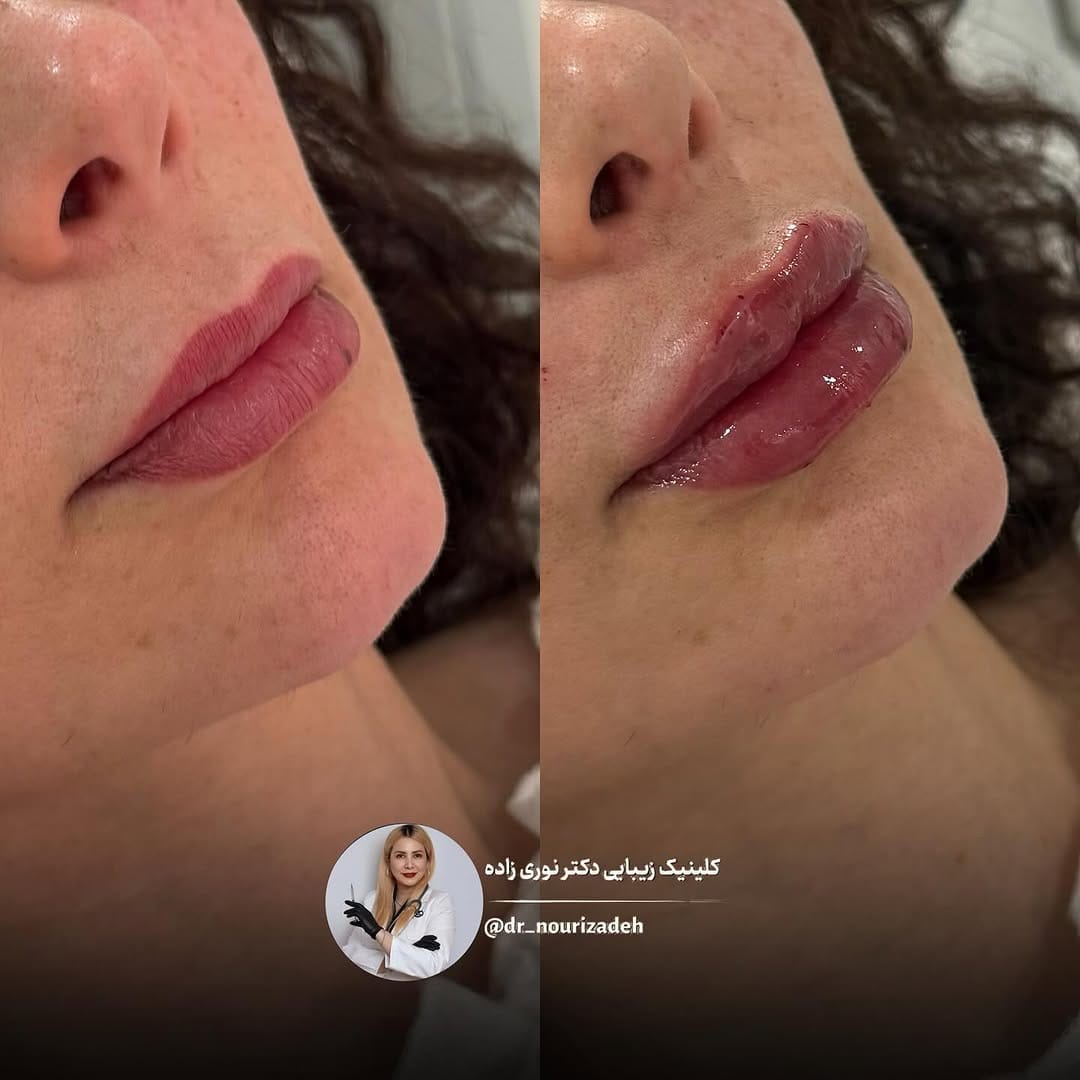Post 3 by Helen Nourizadeh, MD on Instagram (image)