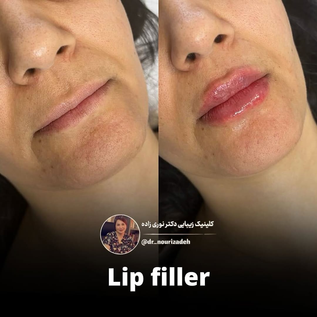 Post 9 by Helen Nourizadeh, MD on Instagram (image)