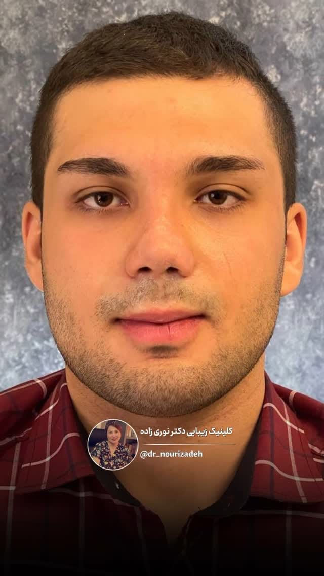 Post 10 by Helen Nourizadeh, MD on Instagram (video)