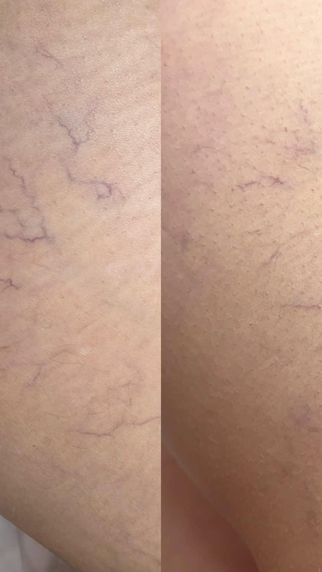 Post 6 by Clinique Skins | Depuis 2007 on Instagram (video)