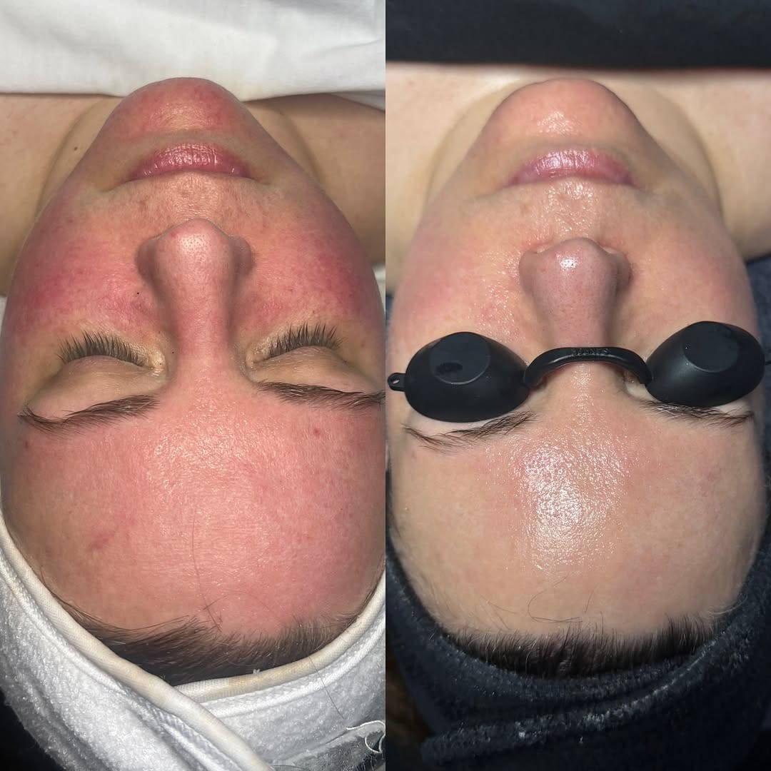 Post 2 by Clinique Skins | Depuis 2007 on Instagram (image)