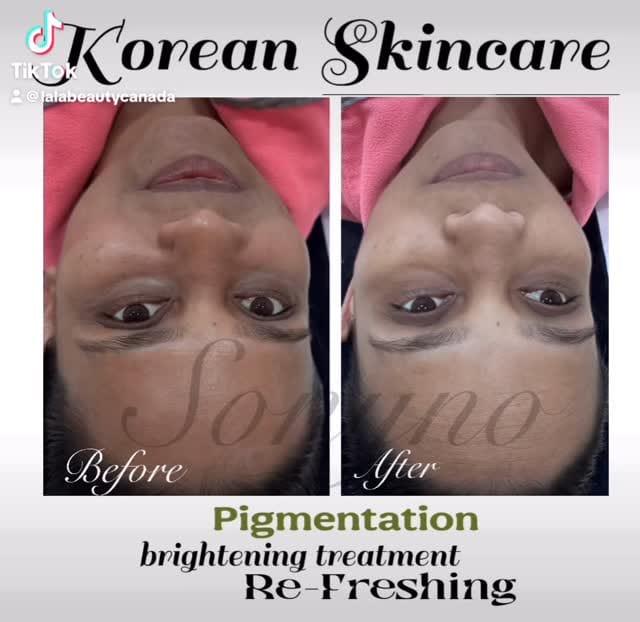 Post 9 by Sonyno Skincare LaLa on Instagram (video)