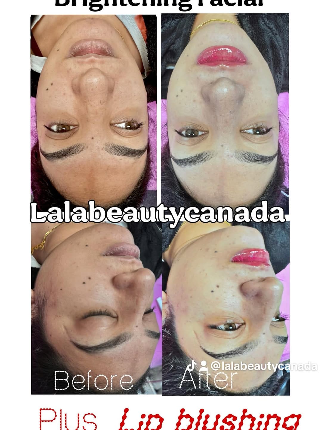 Post 1 by Sonyno Skincare LaLa on Instagram (image)