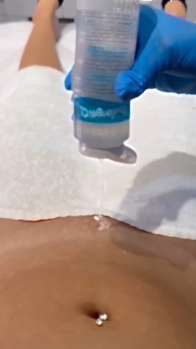 Post 9 by M  ROYAL LASER by Mehrnoosh on Instagram (video)