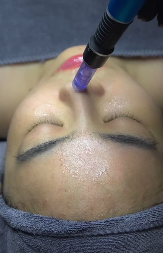 Post 4 by M  ROYAL LASER by Mehrnoosh on Instagram (video)