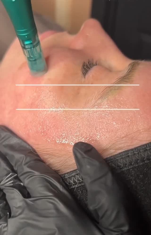 Post 5 by M  ROYAL LASER by Mehrnoosh on Instagram (video)