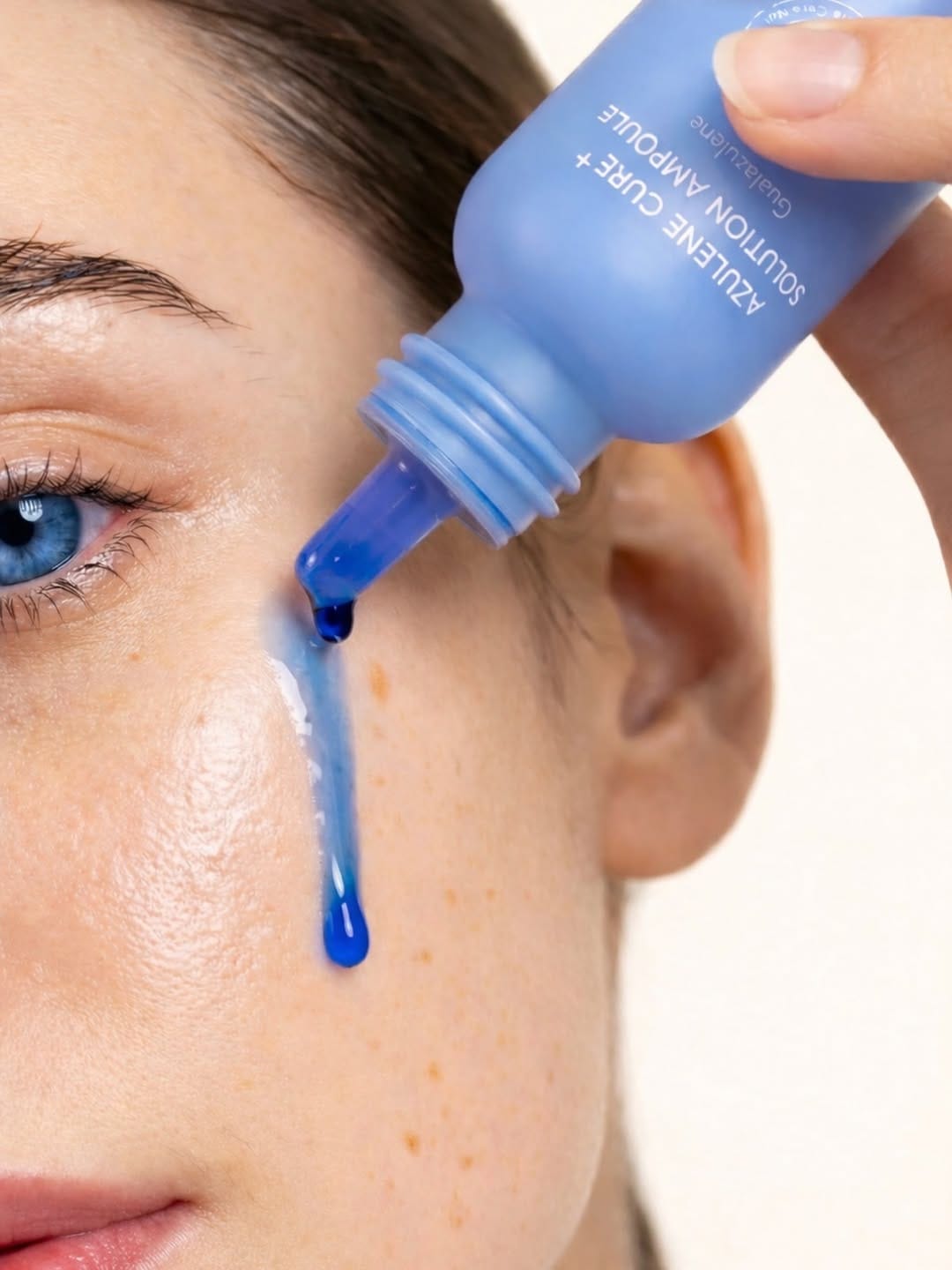 Post 4 by KATHRYN Aerolase Hyperpigmentation Expert GTA on Instagram (image)