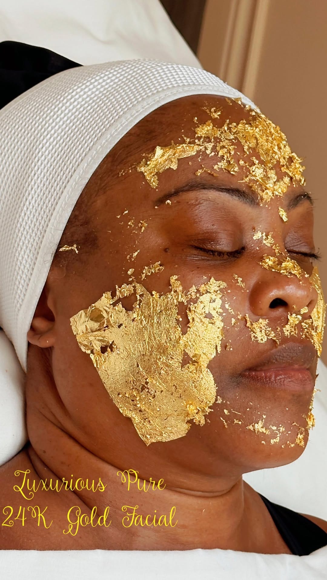 Post 9 by KATHRYN Aerolase Hyperpigmentation Expert GTA on Instagram (video)