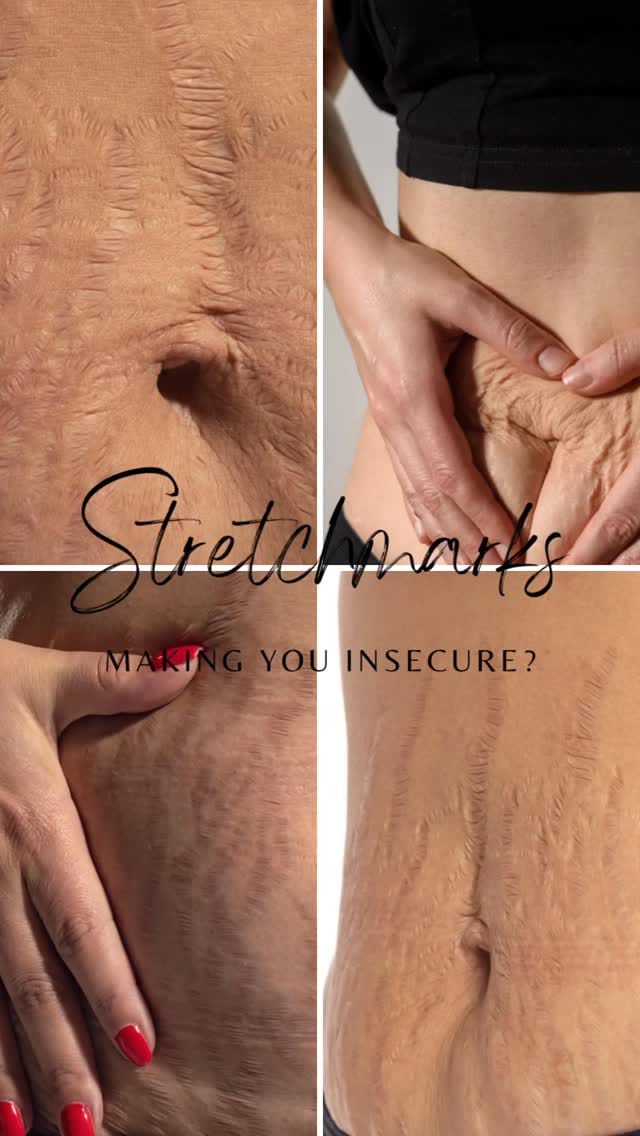 Post 1 by Reveal Medi Spa & Academy on Instagram (video)