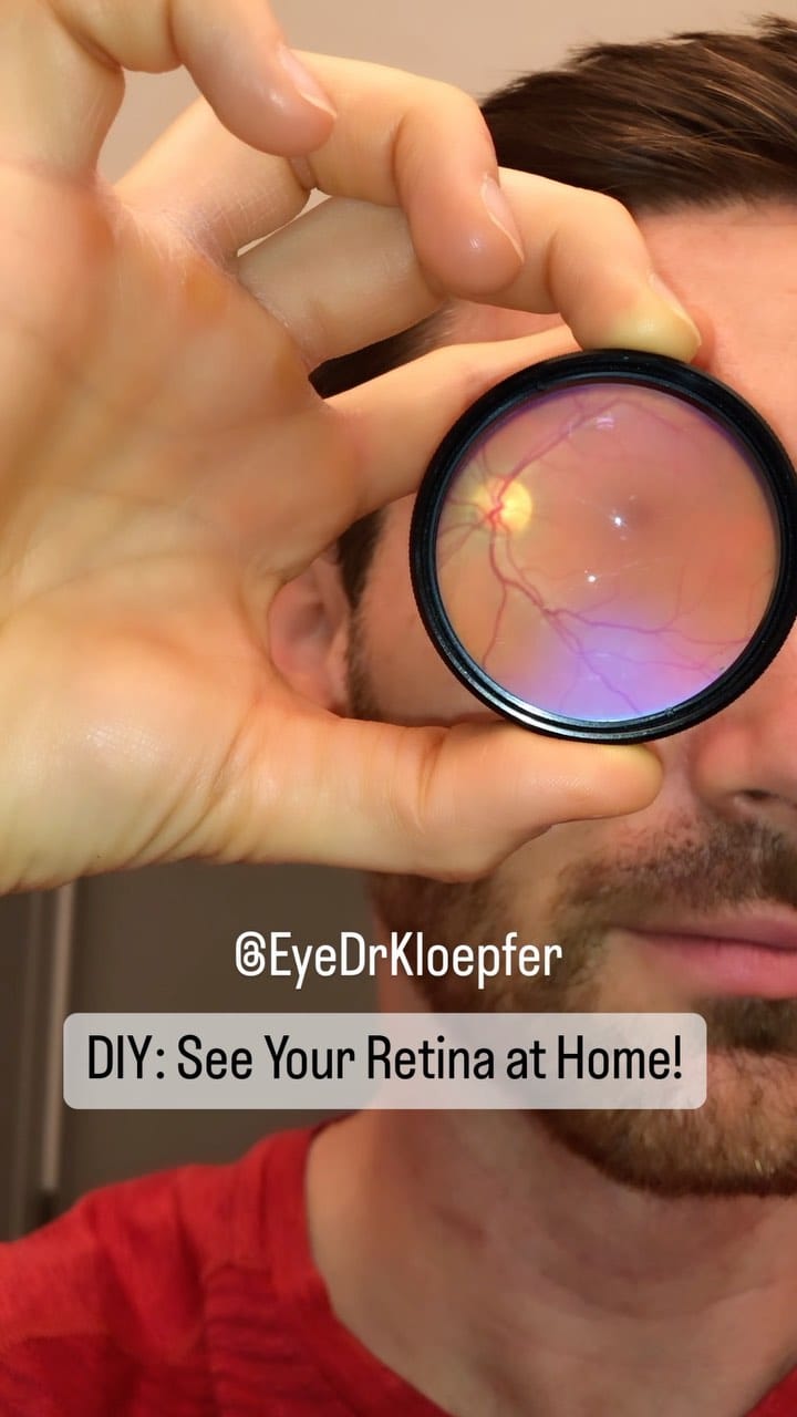 Post 8 by Dr. Rob Kloepfer, Eye Doctor, MBA on Instagram (video)