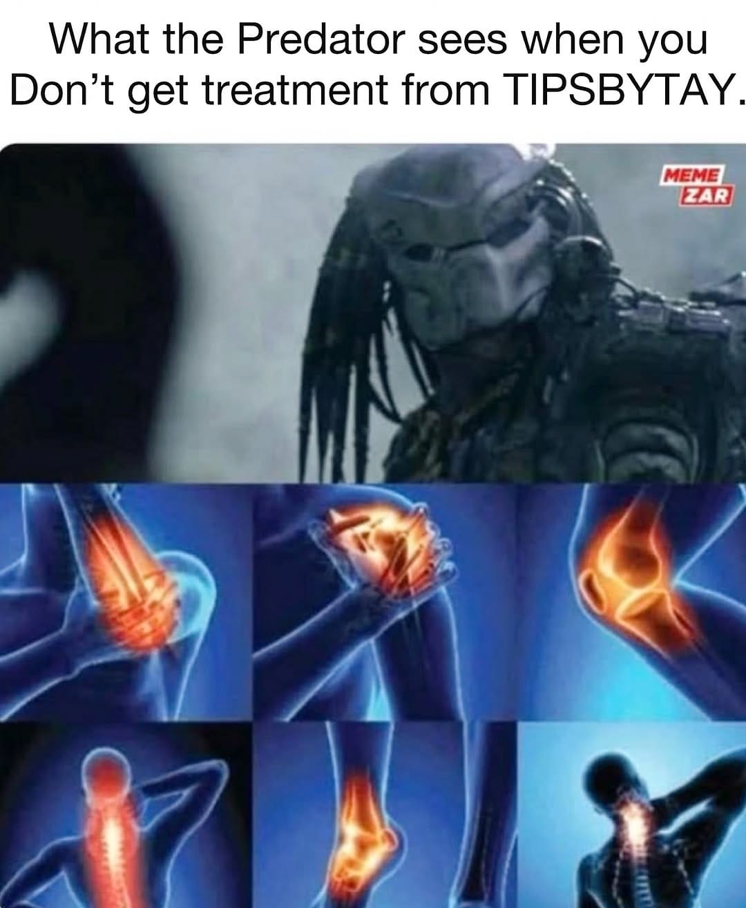 Post 5 by Taylor Plaja 🌎 MUSCLE THERAPY on Instagram (image)