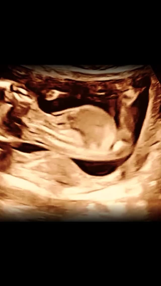 Post 7 by Dalalou Natuurlijk on Instagram (video)