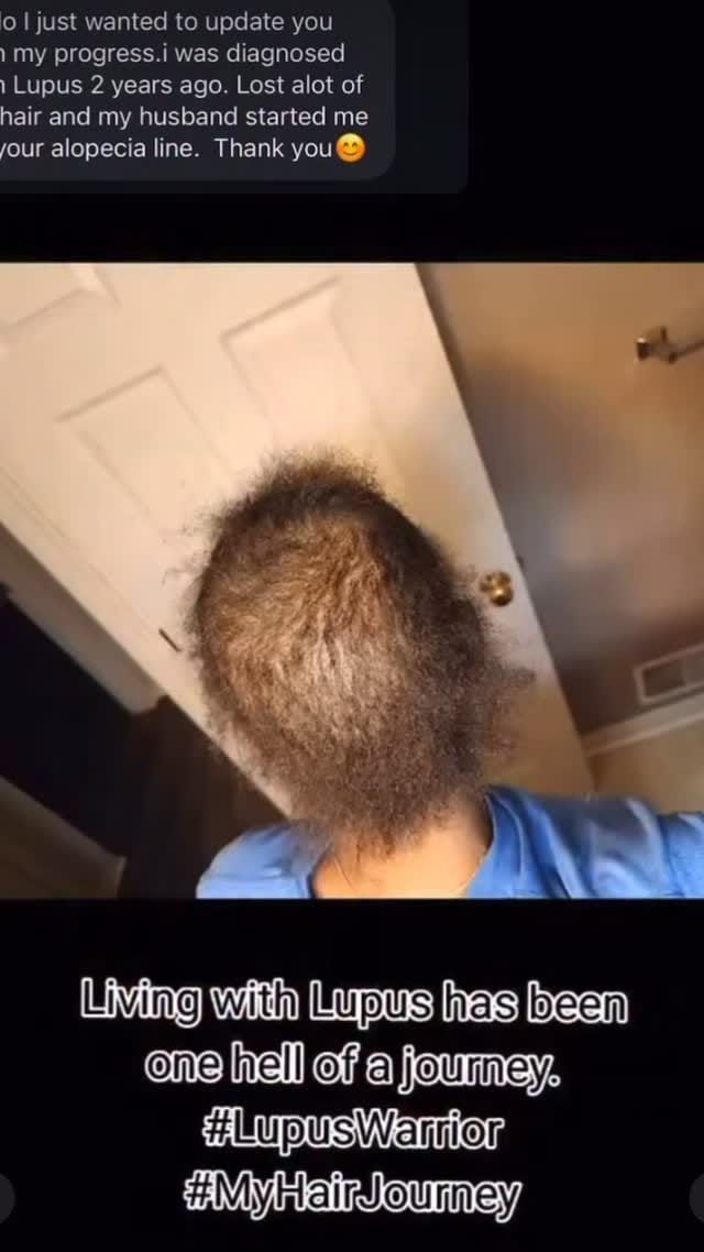 Post 2 by RESTOCK DAY: TBA on Instagram (video)