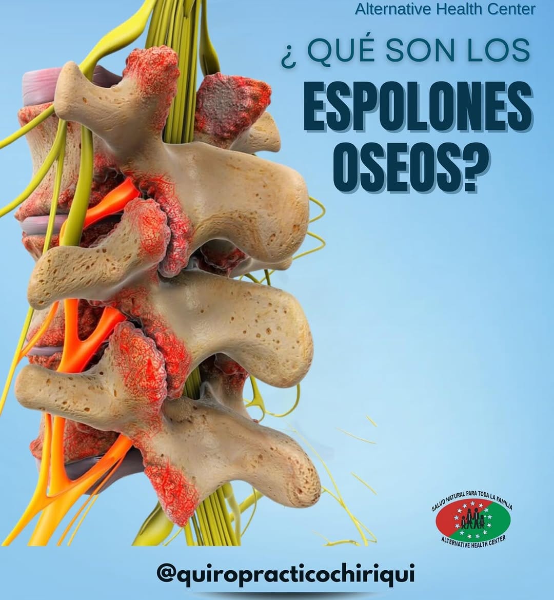 Post 9 by Centro Quiropractico Chiriqui on Instagram (image)