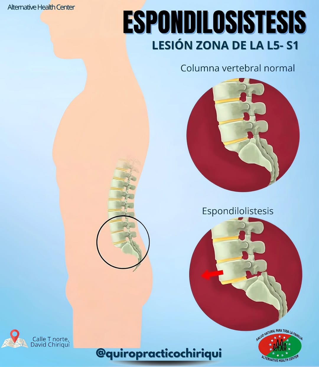 Post 3 by Centro Quiropractico Chiriqui on Instagram (image)