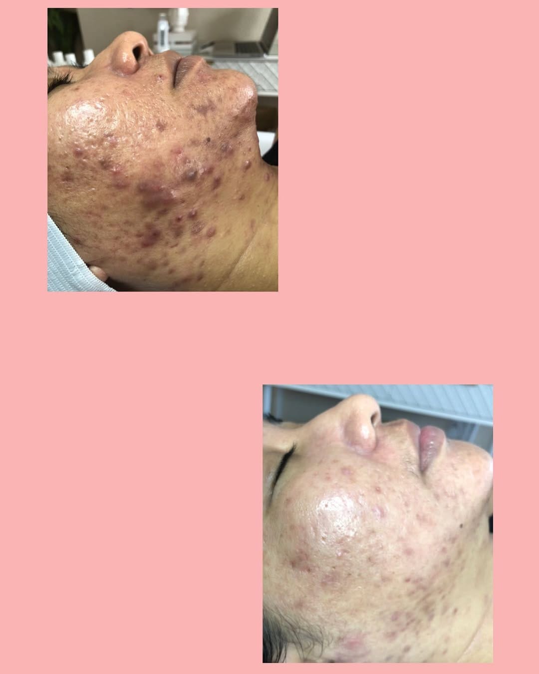 Post 10 by SKIN Allison on Instagram (image)