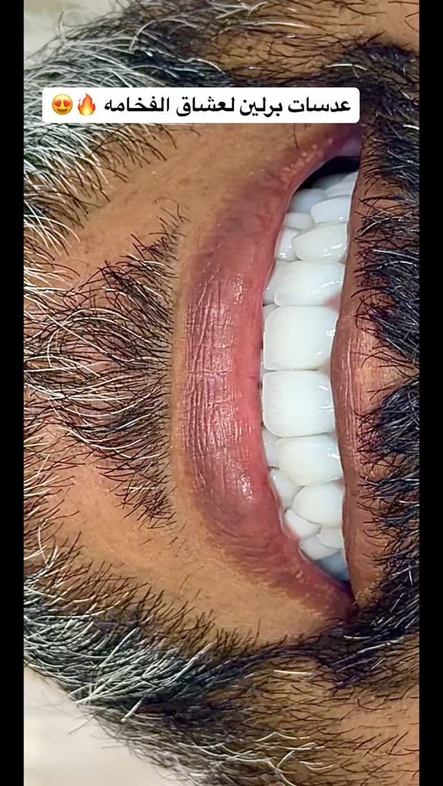 Post 3 by Mohammad Faisal on Instagram (video)